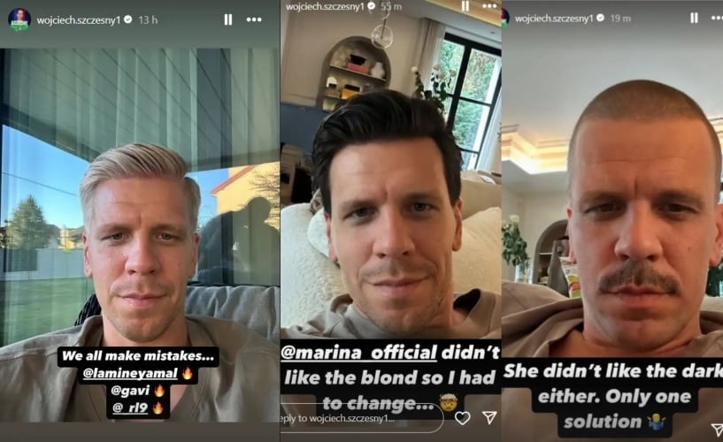 Szczesny cao troc anh 1
