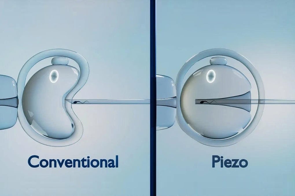 PIEZO ICSI: Công nghệ tạo phôi tiên tiến, nâng cao tỷ lệ thành công trong IVF - 2