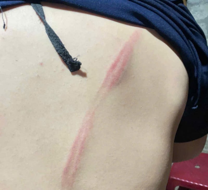 Điều tra vụ việc nam sinh lớp 8 bị hàng xóm xích chân, đánh đập -0
