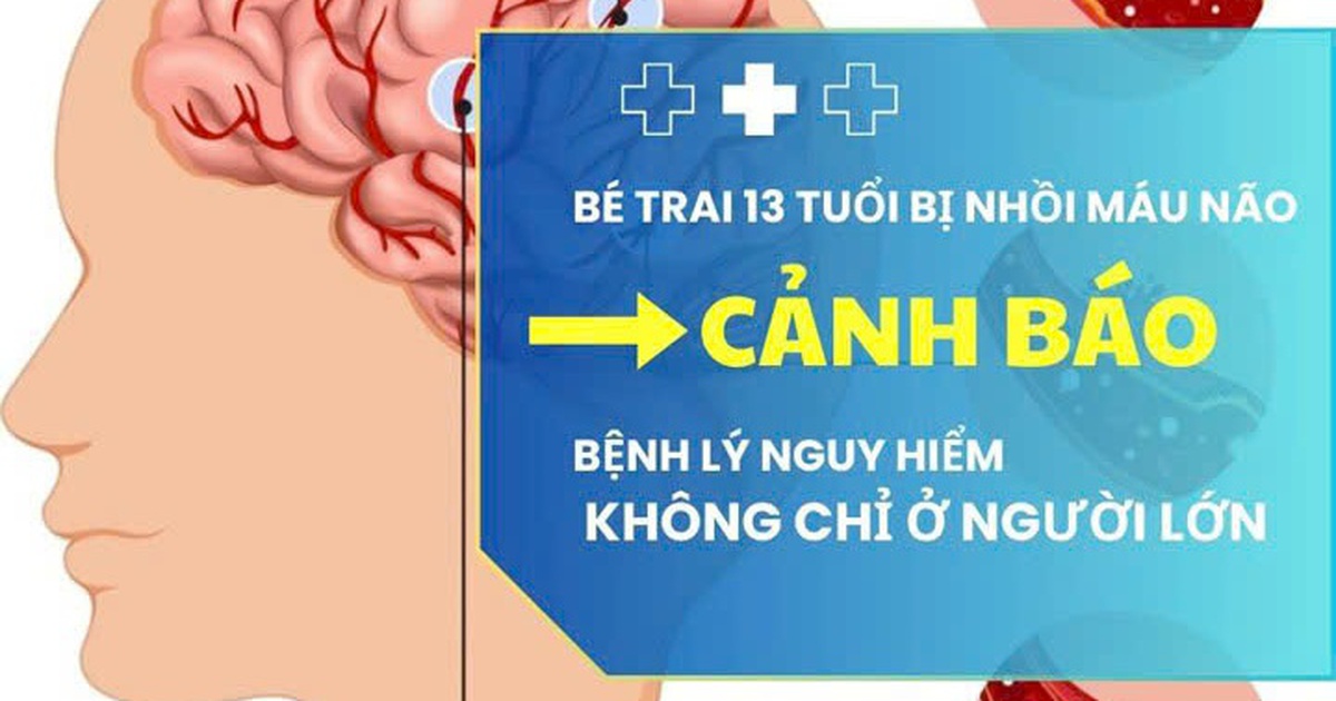 Bé trai 13 tuổi nhồi máu não, cảnh báo nguy cơ đột quỵ ở thiếu niên