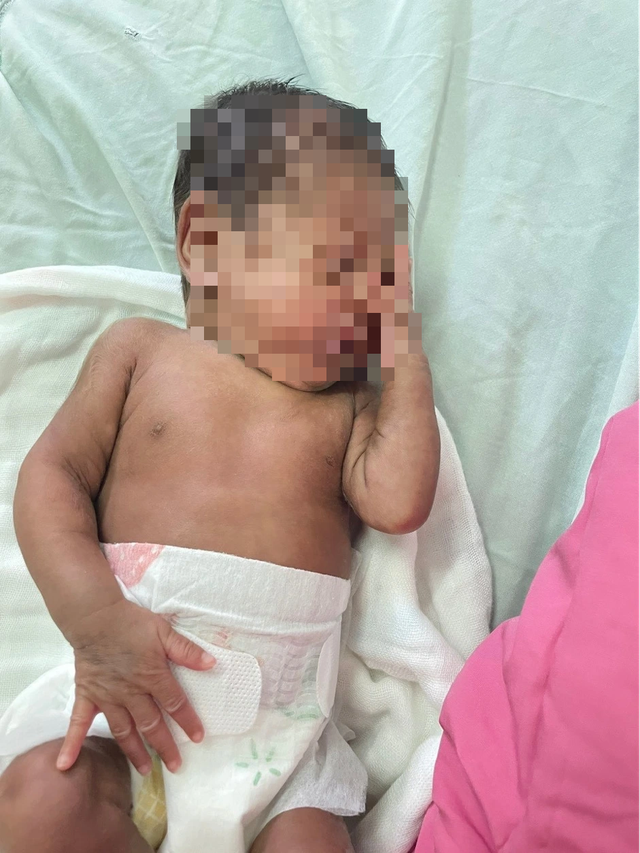 Kỳ tích cứu sống trẻ sơ sinh 700 gram sinh non tại khánh hòa - Ảnh 2.