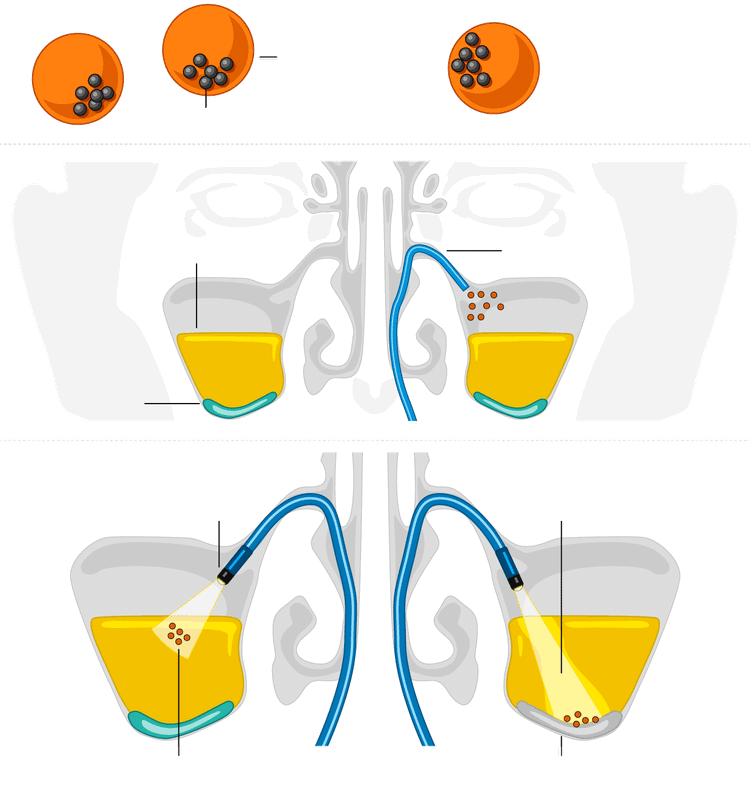sinus-microrobots-inarticle-620.png