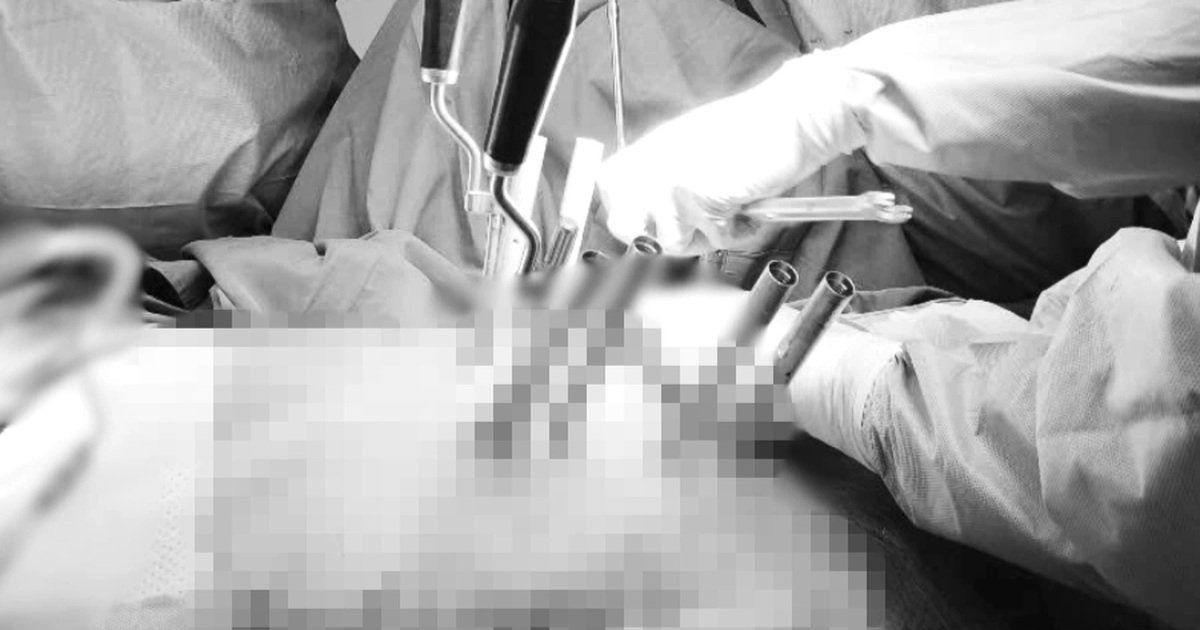 Thang máy đứt cáp rơi thẳng xuống đất, một phụ nữ gãy cột sống nặng nề