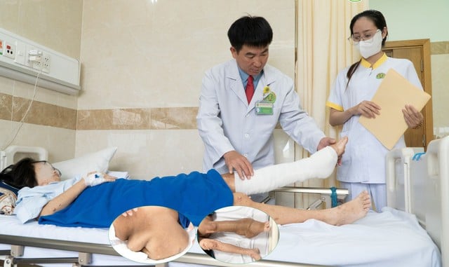 Nữ bệnh nhân 28 tuổi bị khối u sợi thần kinh khổng lồ  - Ảnh 1.