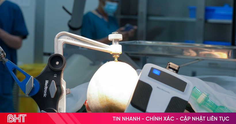 Robot AutoGuide lần đầu xuất hiện tại Việt Nam: Bước ngoặt công nghệ trong điều trị động kinh