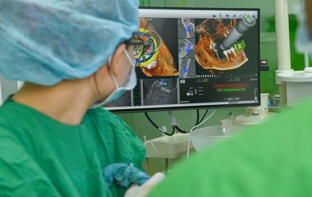 Ứng dụng 'GPS nha khoa' X-Guide: Bước tiến mới trong cấy ghép Implant- Ảnh 2.