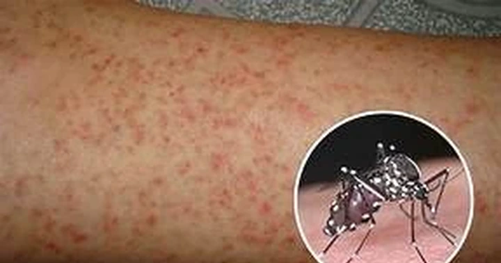 Tăng cường công tác phòng, chống bệnh sốt xuất huyết