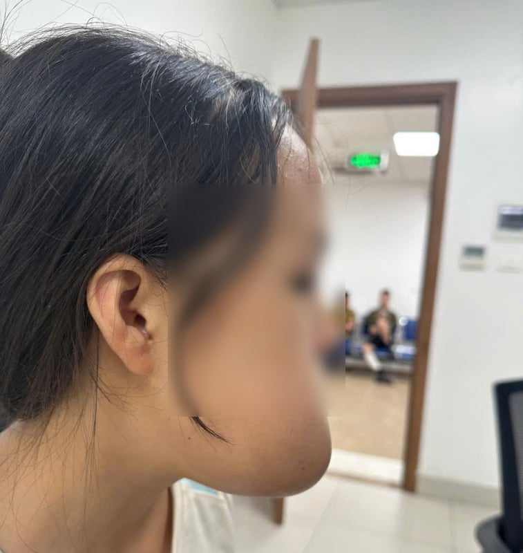 Phẫu thuật miễn phí cho thiếu nữ người dân tộc thoát khỏi khối u khổng lồ -0