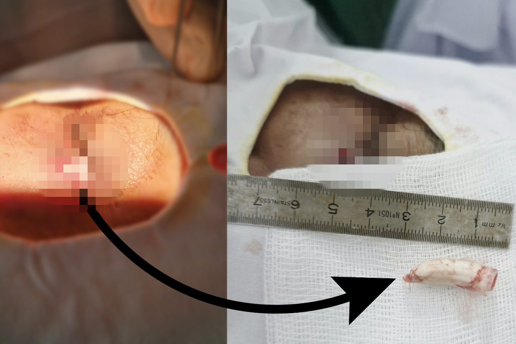 Người đàn ông suýt mù vì bị... gà trống nhảy lên đá vào mặt - 1