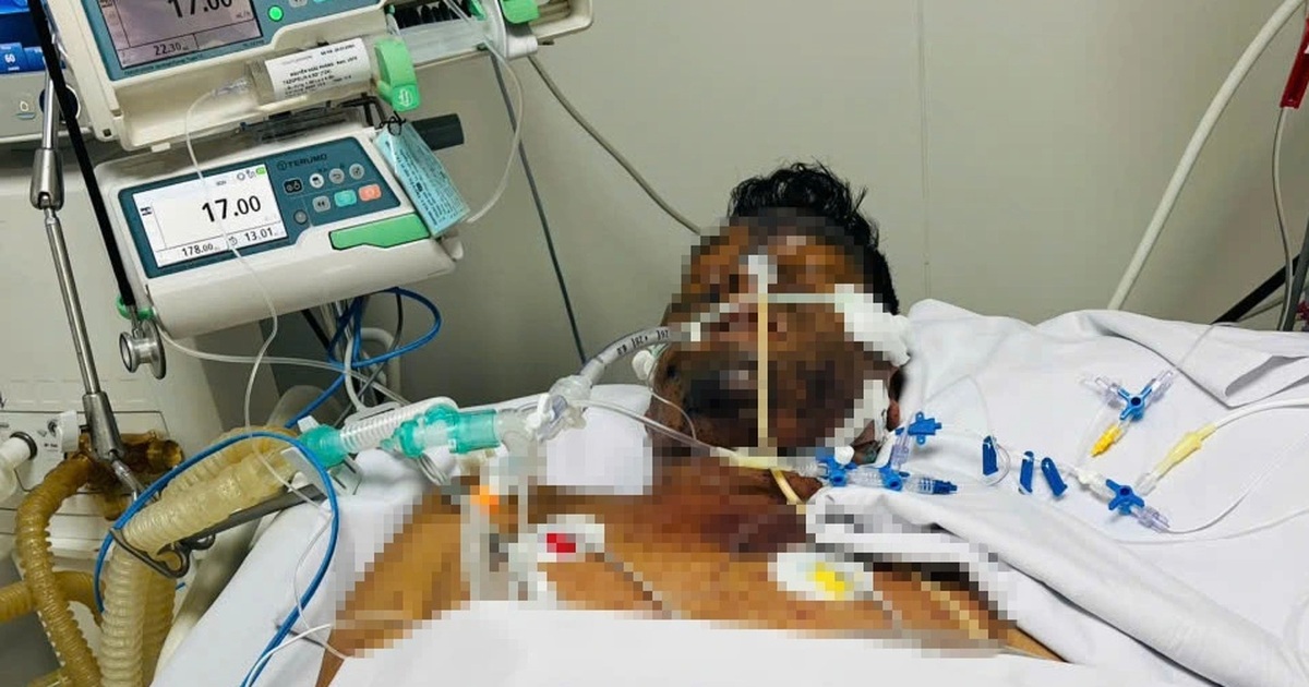 From being healthy, suddenly fell into a coma, owing hundreds of millions of dong due to chickenpox