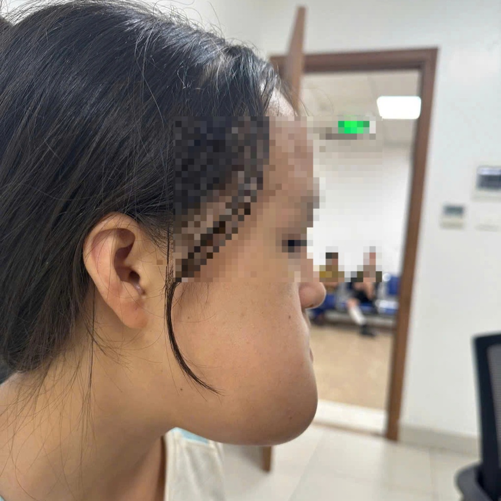 Sau 9 giờ phẫu thuật, bác sĩ giải cứu thiếu nữ khỏi khối u khổng lồ ở mặt - 1