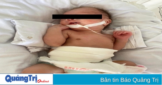 Cứu sống thành công bệnh nhi 35 tuần bị thủng dạ dày