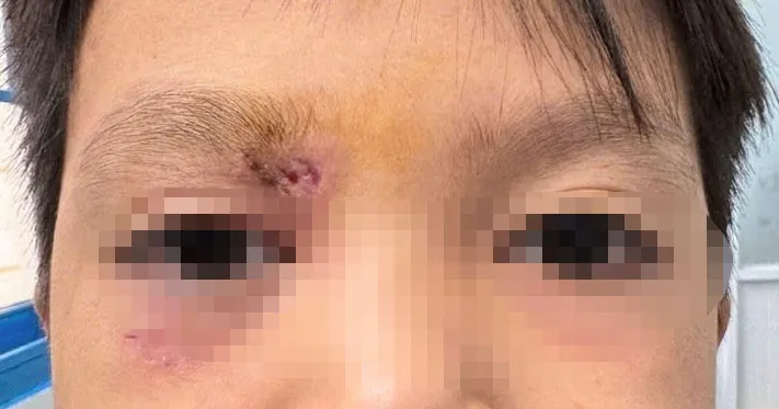 Bệnh nhi đã qua cơn nguy hiểm