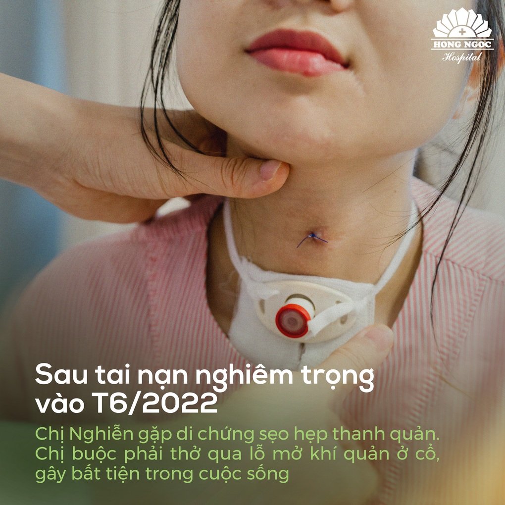 Phẫu thuật sẹo hẹp thanh quản, “tái sinh” hơi thở sau 2 năm sống nhờ ống thở nhân tạo - 2