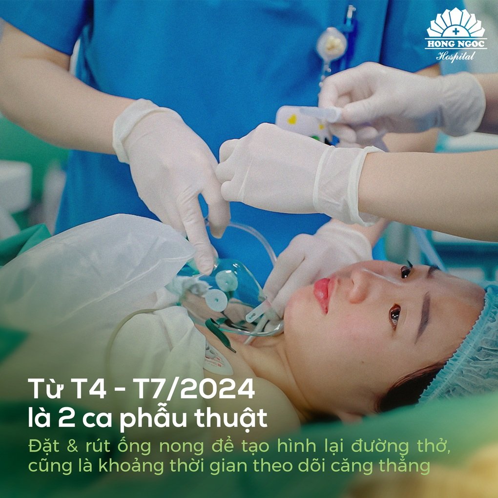 Phẫu thuật sẹo hẹp thanh quản, “tái sinh” hơi thở sau 2 năm sống nhờ ống thở nhân tạo - 5