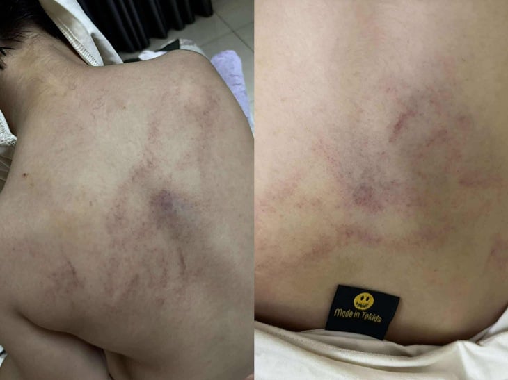 Gia đình tố cô giáo mầm non đánh, kéo lê, ném bé gái 4 tuổi vào tường - Ảnh 1.