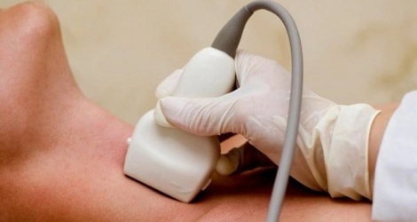 Cảnh giác với viêm tuyến giáp bán cấp từ những triệu chứng tưởng chừng đơn giản