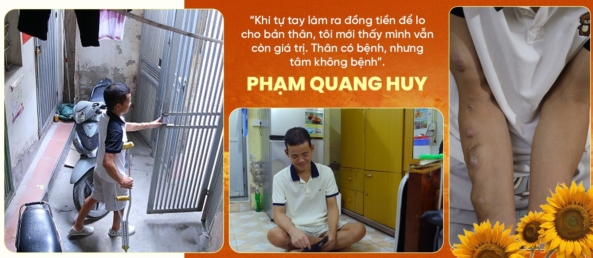 9X suy thận chống nạng làm TikTok, 8 năm cãi số từ phòng trọ 4m2 - 15