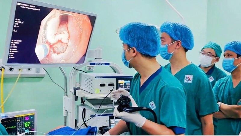 Mr. C received endoscopic ESD intervention at Thai Nguyen Central Hospital to treat esophageal cancer.