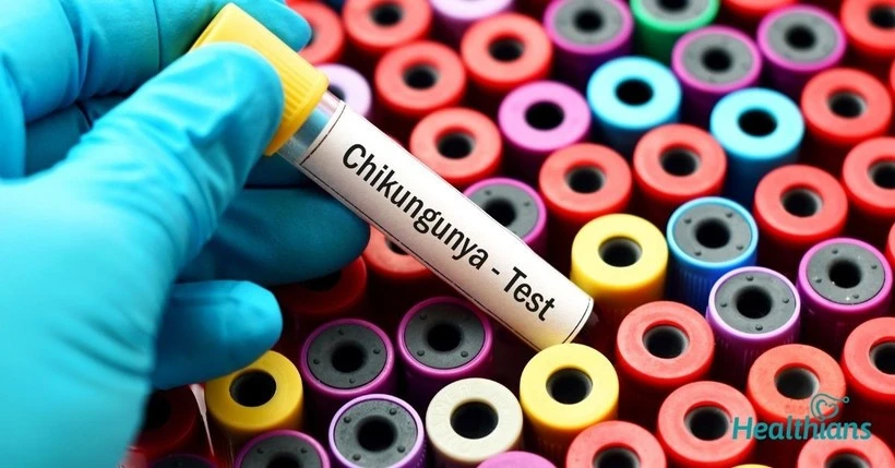 Tăng cường giám sát dịch Chikungunya ngay tại cửa khẩu, cơ sở y tế