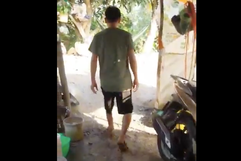 Kỳ diệu: 1 năm sau khi bị tai nạn đứt lìa chân, nam công nhân đã đi được - 2