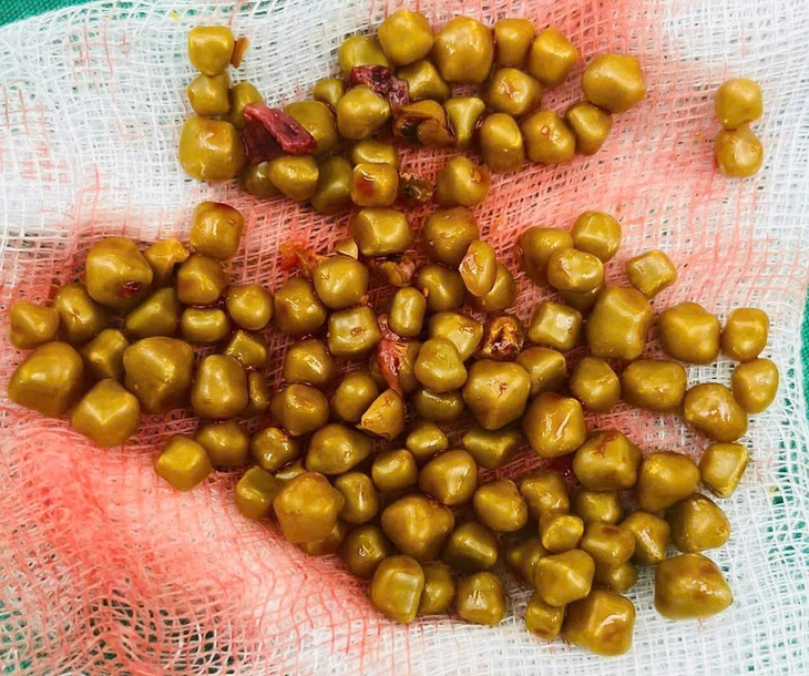 cấp cứu  - Ảnh 1.
