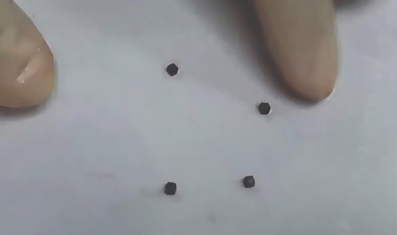 Bé trai 6 tuổi thủng ruột do nuốt 4 cục nam châm  -0