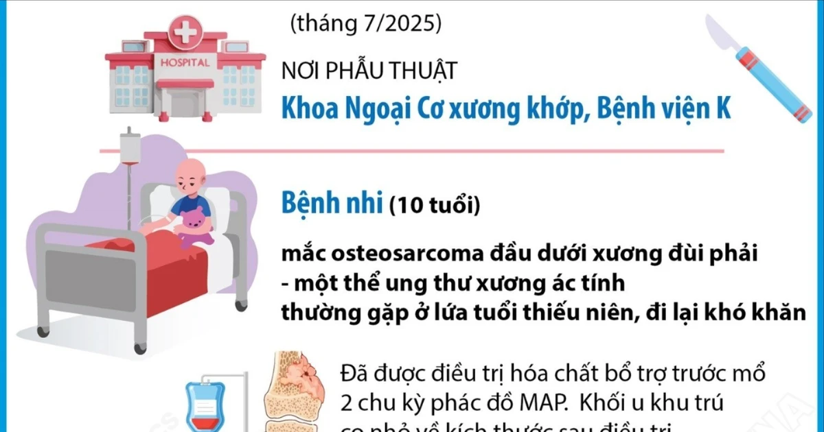 Lần đầu thay khớp gối bản lề tăng trưởng cho bệnh nhi ung thư xương