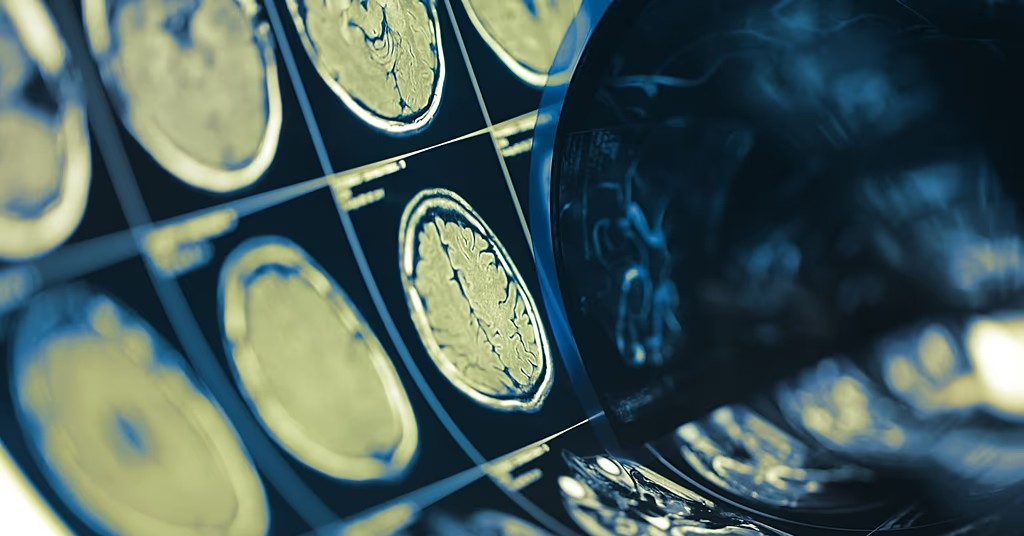 Mind-reading brain chip with 74% accuracy: Blessing or nightmare?