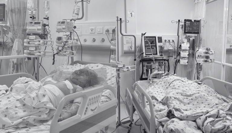 Hai chị em nhập viện trong tình trạng nguy kịch vì bị phóng hỏa bởi cha ruột -0