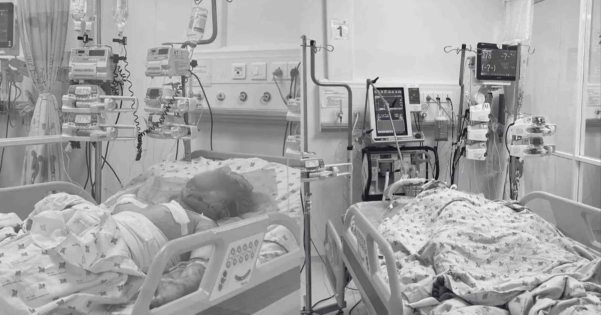 Emergency treatment for two children with severe burns, suspected of being set on fire by their father
