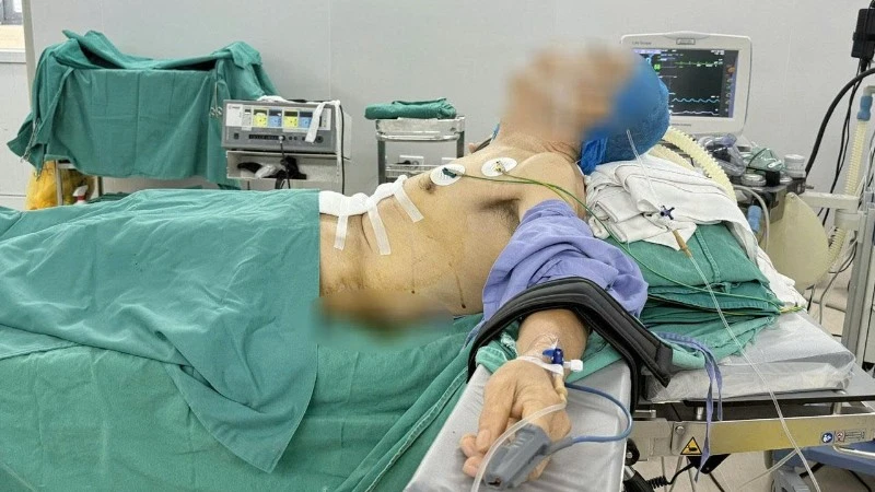 Cirugía especial para paciente con cáncer de estómago y escoliosis severa