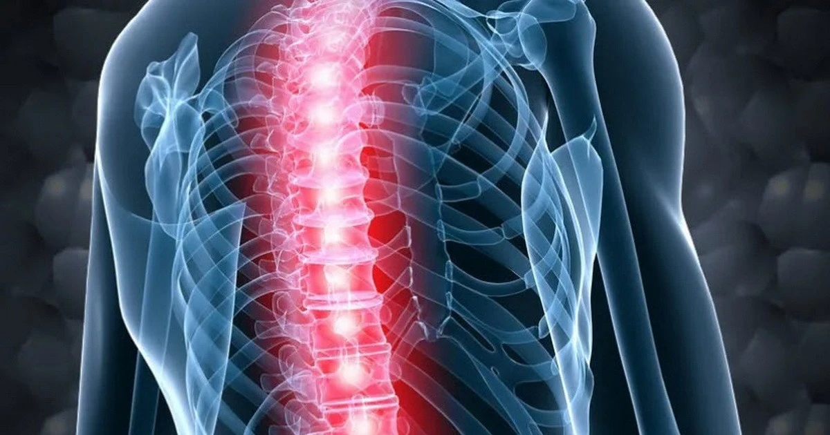 Israel chuẩn bị ca cấy ghép tủy sống đầu tiên trên thế giới bằng tế bào tự thân