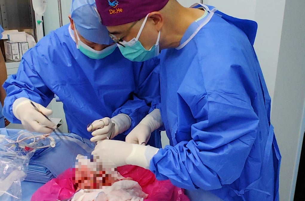 First pig lung transplant to human - 1