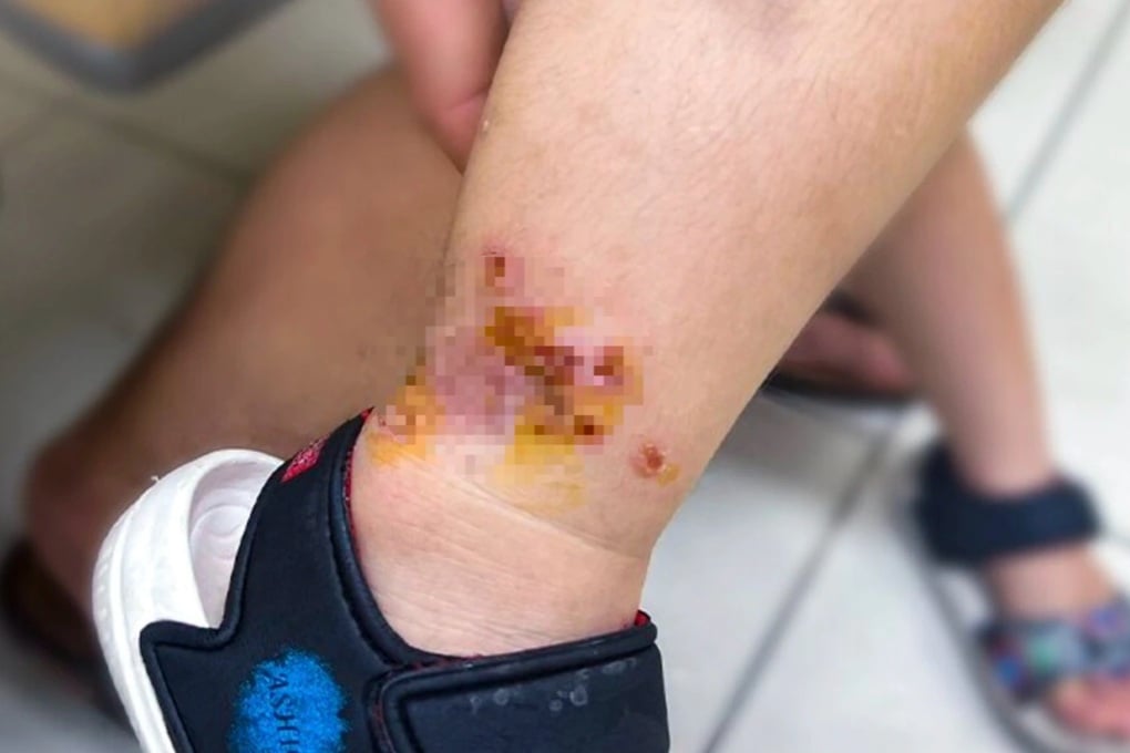 Mưa lớn kéo dài, TPHCM tăng mạnh người đi khám da: Bệnh nào nhiều nhất? - 2