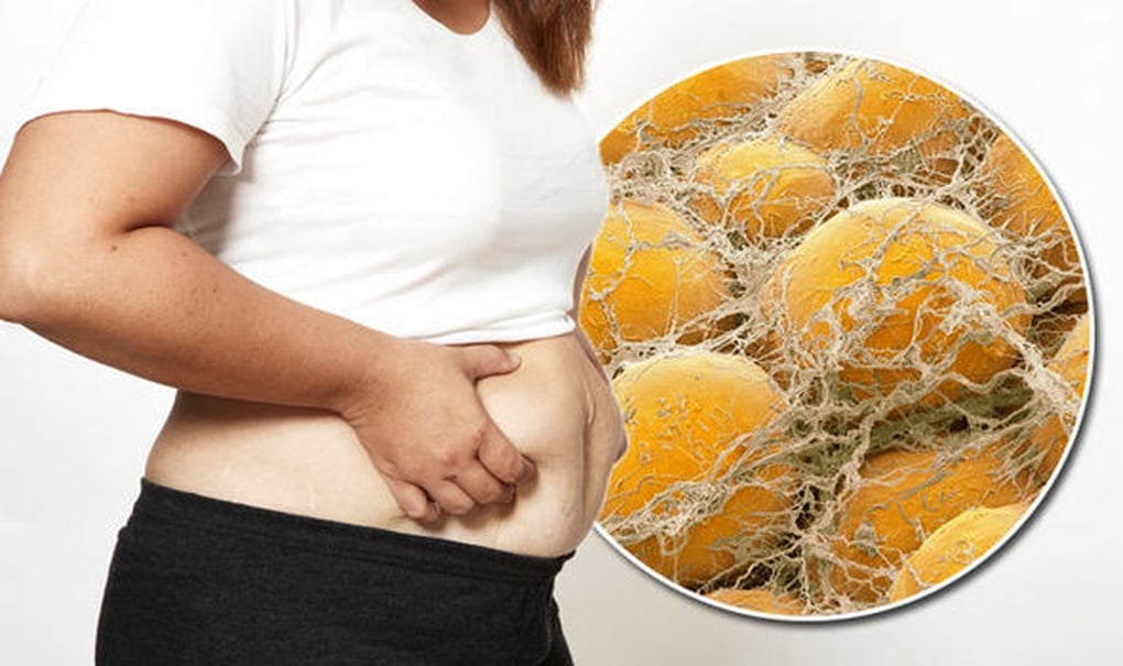 Làm thế nào để loại bỏ mỡ nội tạng nhanh chóng? - 1