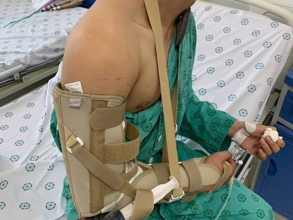 Chơi vật tay, chàng trai Hà Nội gãy xương - 2