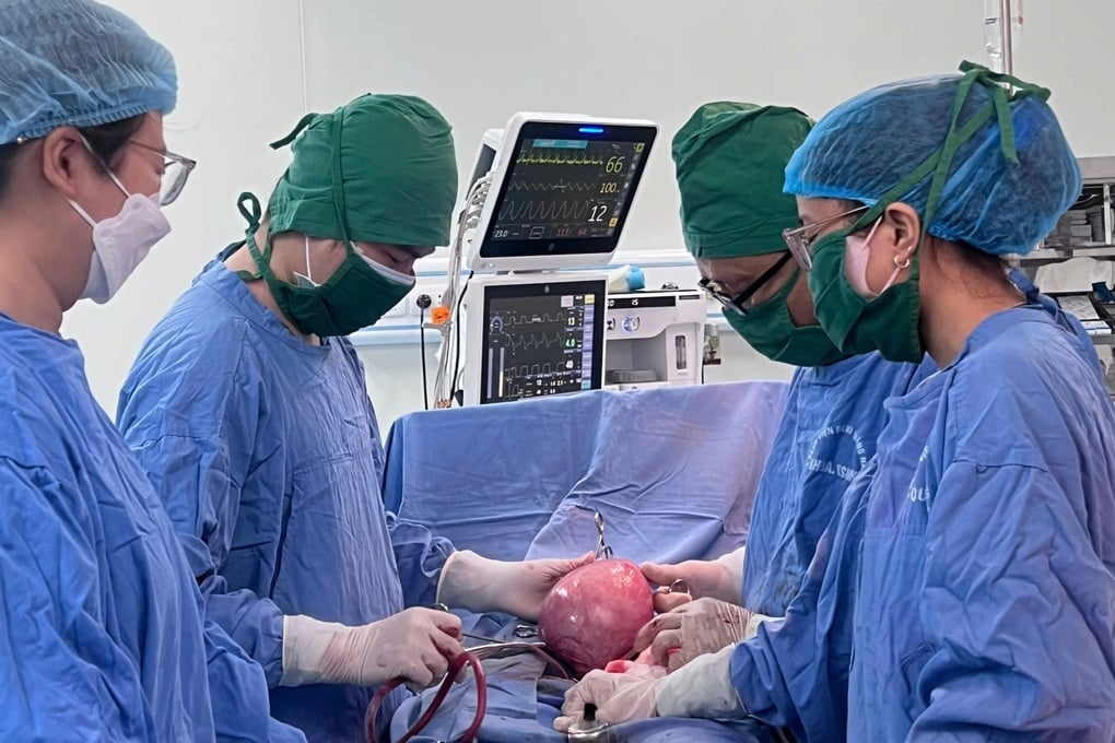 Người phụ nữ mang khối u xơ tử cung nặng 3kg, tương đương một thai nhi - 1