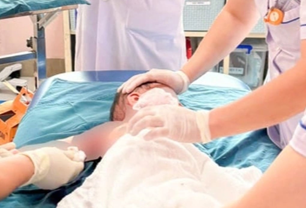 Hà Nội: 3 trẻ trong một gia đình bị bỏng do lật nồi lẩu - 1