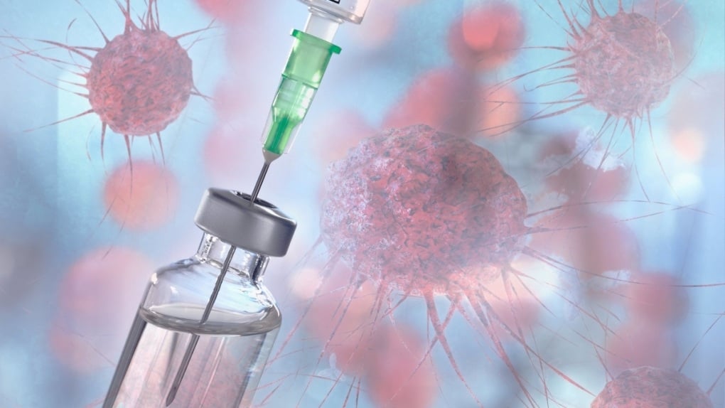 Chuyên gia kỳ vọng vaccine ung thư của Nga: Xóa án tử, thêm cơ hội sống - 3