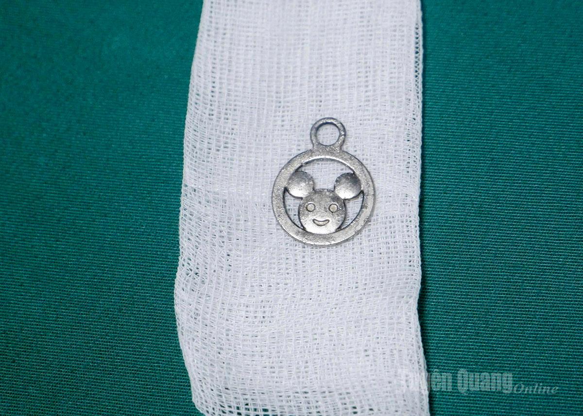 Foreign objects stuck above the esophagus were removed, ensuring the safety of baby Ly D.D.