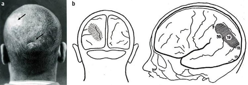 Câu chuyện kỳ lạ của người đàn ông nhìn thế giới ngược - 2