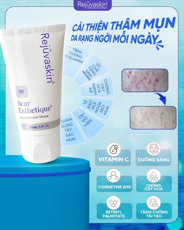 Đừng mắc sai lầm khi chọn kem làm mờ sẹo: Chia sẻ từ chuyên gia da liễu - Ảnh 2.
