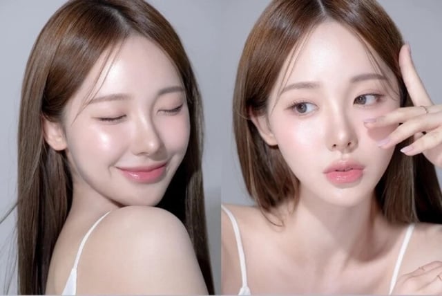  - Ảnh 1.