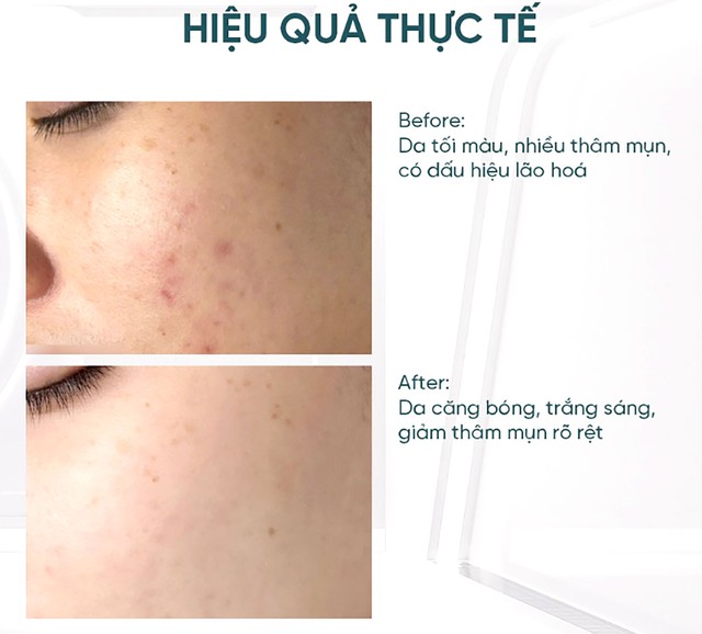 3 serum trắng da, chống lão hóa giúp nàng 30+ ‘hack tuổi’, lên kệ là mua luôn- Ảnh 2.
