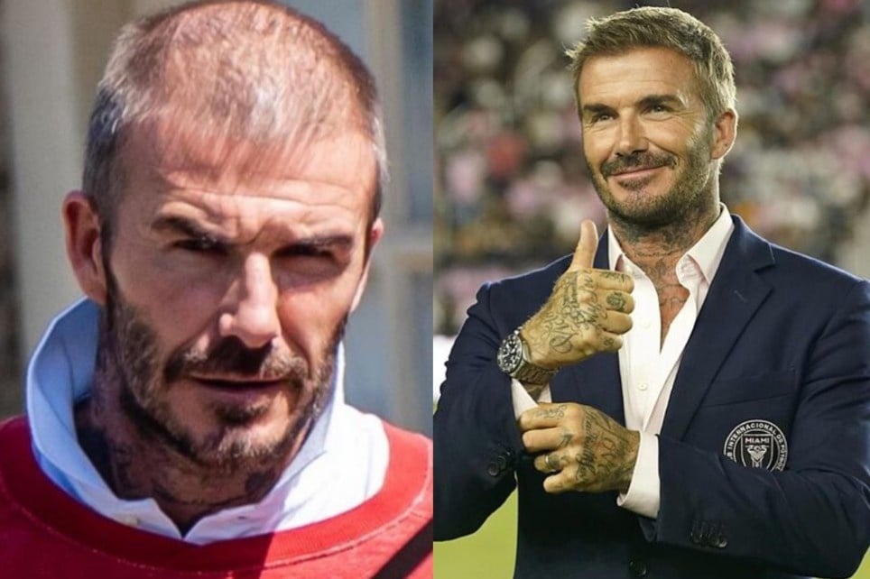 Beckham cay toc anh 1
