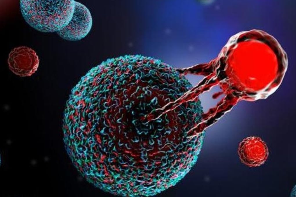Bác sĩ bệnh viện tuyến cuối nói gì về liệu pháp CAR-T cell trị ung thư máu? - 3