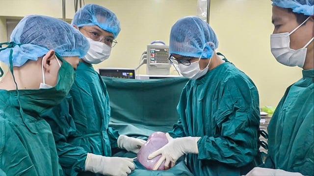 Quảng Ngãi: Cắt bỏ khối u buồng trứng ‘khủng’ 5,5 kg cho nữ bệnh nhân 19 tuổi- Ảnh 1.