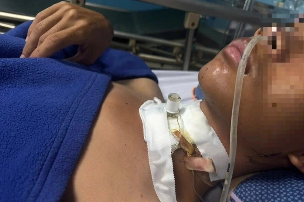 Nam thanh niên bị đứt lìa khí quản vì vướng vào dây điện giữa đường - 1