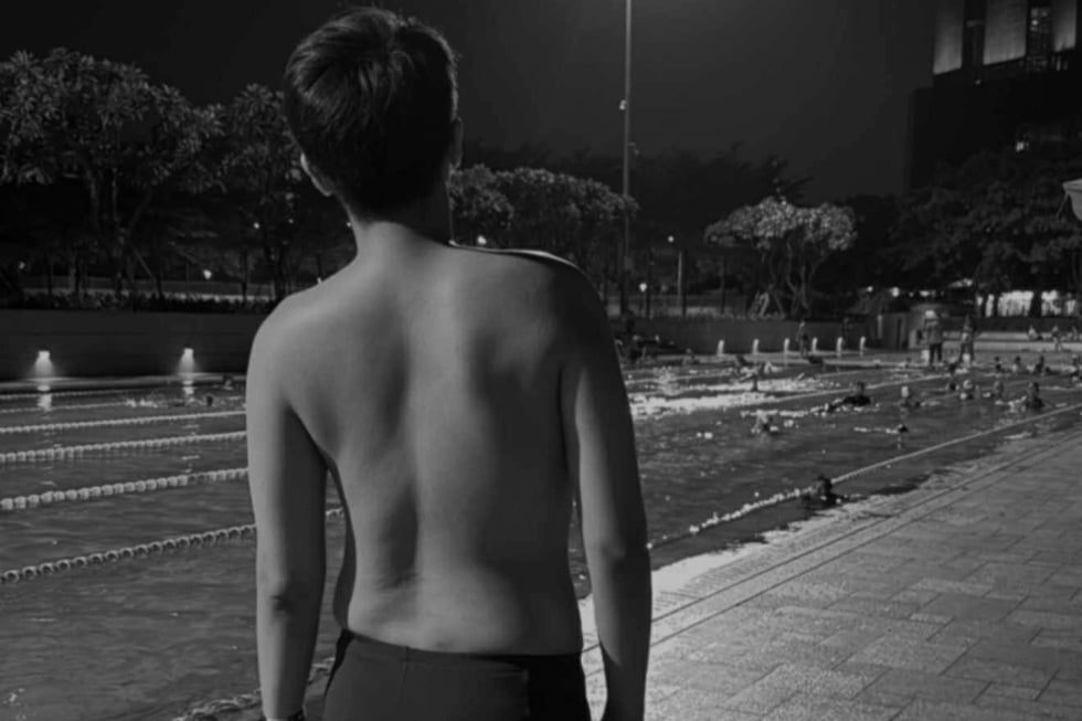 Dân văn phòng vai lệch nặng, cột sống cong vẹo trước tuổi 30 - 1